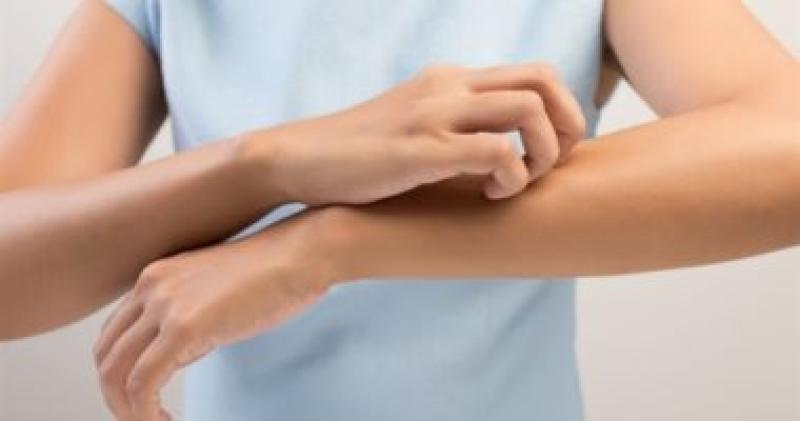 أشياء تسبب حساسية البشرة.. منها استخدام المناديل المعطرة