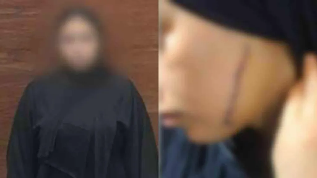 الأمن يضبط ربة منزل اعتدت على فتاة بآلة حادة بسبب نية طليقها الزواج منها