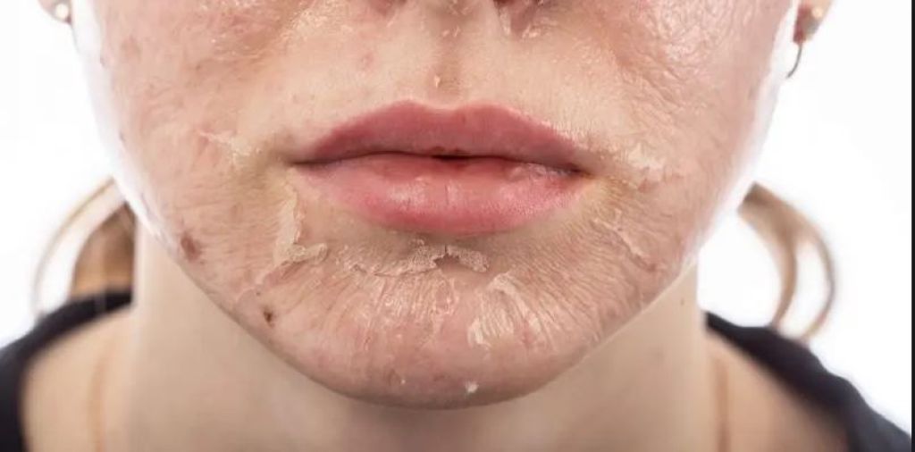 10 افضل كريم تقشير للوجه​ في السعودية 2025