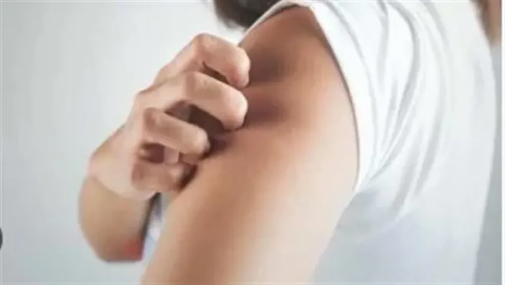 مع دخول الشتاء.. خبير جلدية توضح أسباب زيادة أعراض الصدفية وطرق مواجهتها مع دخول الشتاء.. خبير جلدية توضح أسباب زيادة أعراض الصدفية وطرق مواجهتها