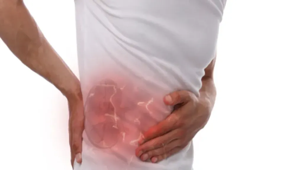 مرض الكلى المزمن يتفشى عالميا.. كيف أصبح 14% من سكان العالم معرضين له؟