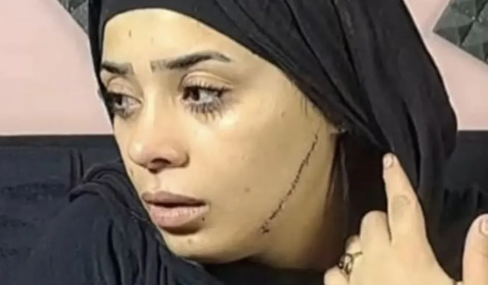 ضربتها بالموس.. محاكمة المتهمة بتشويه وجه عروس طليقها في مصر القديمة
