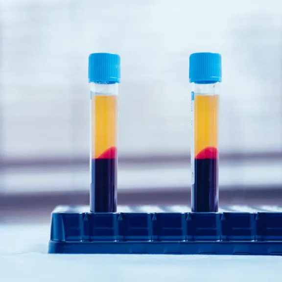 مصر تصبح سادس دولة في العالم تحقق الاكتفاء الذاتي من البلازما