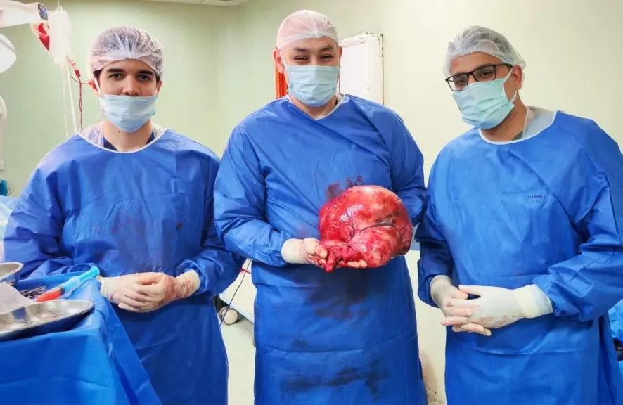 محافظ بني سويف يشيد بطاقم طبي استأصل ورما سرطانيا يزن 15 كيلوجراما لسيدة مسنّة