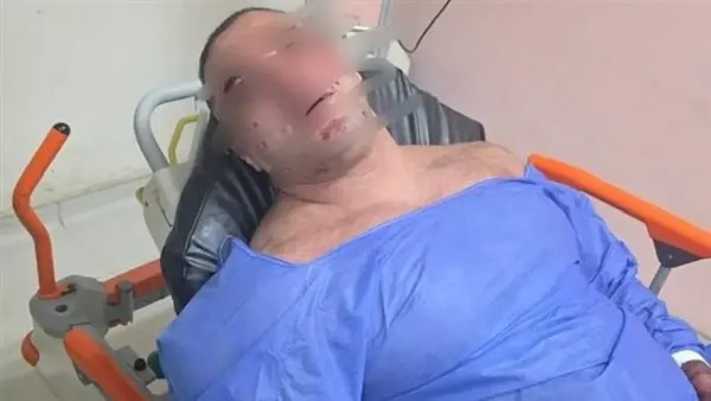 القصة الكاملة في واقعة إطلاق نار على مدير ”جولدن جيم” وإصابته بجروح بالشيخ زايد