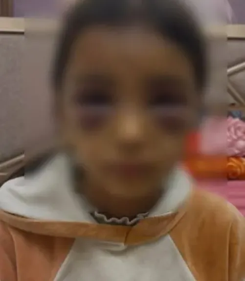 حبس سيدة بتهمة تعذيب ابنتي زوجها في الشرقية