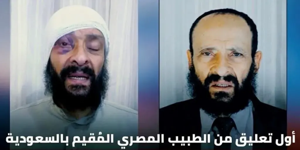 30 سنه في الغربة وأبنه الكبير ضربة وطردة من البيت .. طبيب بالسعودية يكشف تفاصيل صادمة