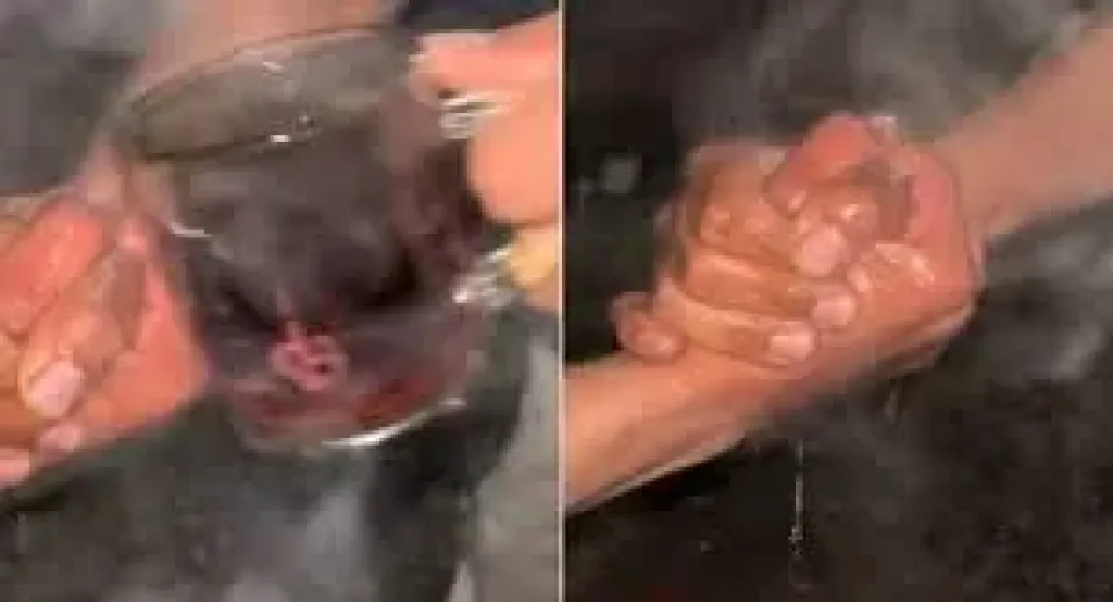 تحدي ”الشاي المغلي” تريند يتحول لحروق وعاهات مستديمة .. وزارة الصحة تحذر وتوضح التداعيات