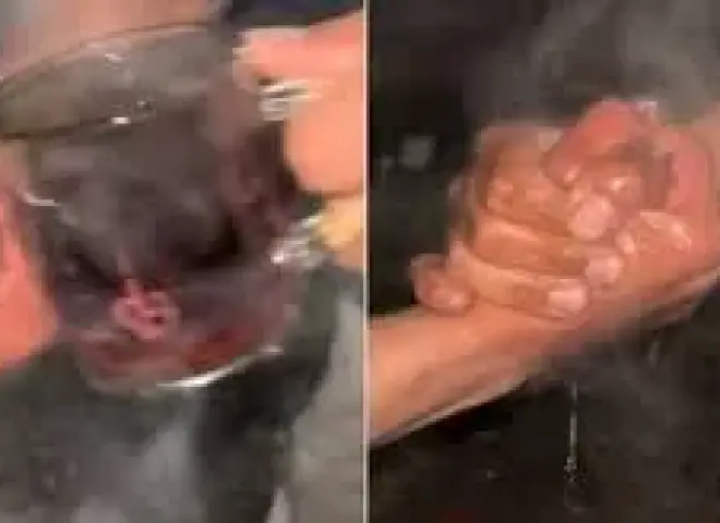 تحدي ”الشاي المغلي” تريند يتحول لحروق وعاهات مستديمة .. وزارة الصحة تحذر وتوضح التداعيات