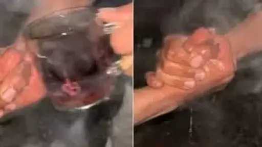 تحدي ”الشاي المغلي” تريند يتحول لحروق وعاهات مستديمة .. وزارة الصحة تحذر وتوضح التداعيات