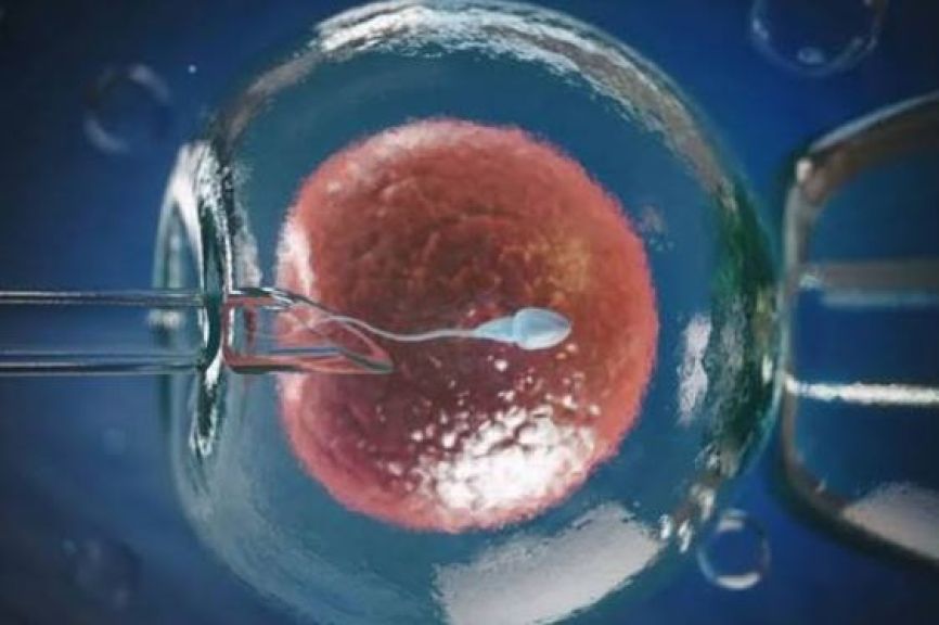 الحقن المجهري