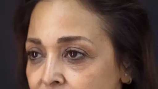 شكلها أتغير خالص .. داليا البحيري بعد عملية التجميل تعود لسن الثلاثين