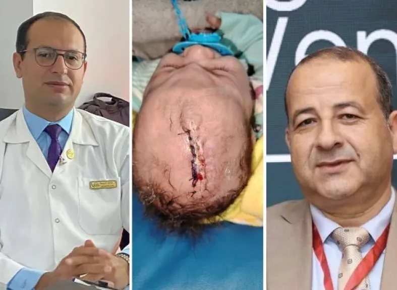جراحة دقيقة بمستشفى جامعة الأزهر بدمياط الجديدة تنقذ رضيعا من تشوه وعائي نادر