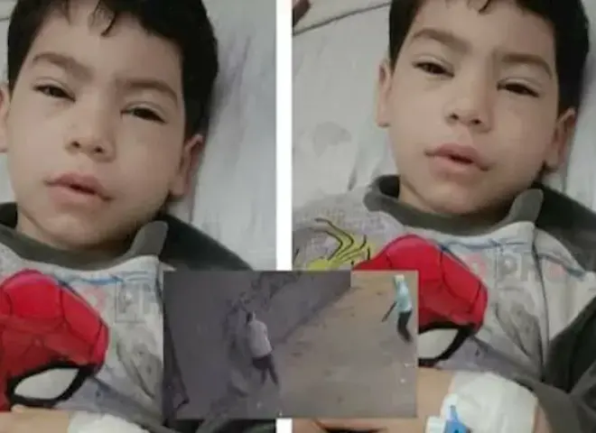 هل تعرض طفل باسوس لبتر في قدمه؟ مصدر بالصحة يكشف الحقيقة قبل الجراحة