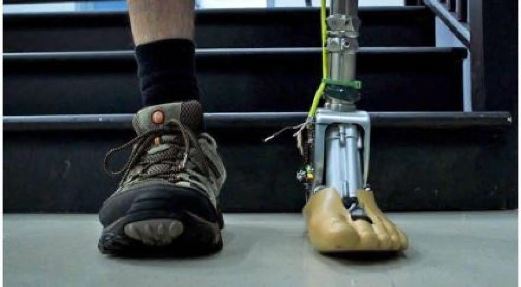 طرف صناعي تحت الركبة المانى