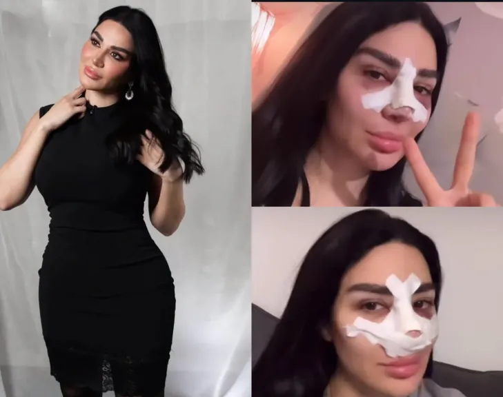 بعد أزمة تنفس وعملية في الوجه.. سارة نخلة تكشف تفاصيل صادمة عن حالتها الصحية وتطورات التعافي