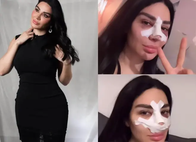 بعد أزمة تنفس وعملية في الوجه.. سارة نخلة تكشف تفاصيل صادمة عن حالتها الصحية وتطورات التعافي