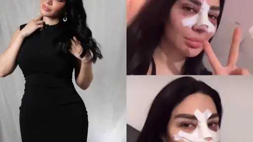 بعد أزمة تنفس وعملية في الوجه.. سارة نخلة تكشف تفاصيل صادمة عن حالتها الصحية وتطورات التعافي