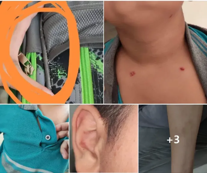 استغاثة لوزير التعليم.. ولية أمر تتهم مدرسة بالإهمال بعد تعرض نجلها للتنمر