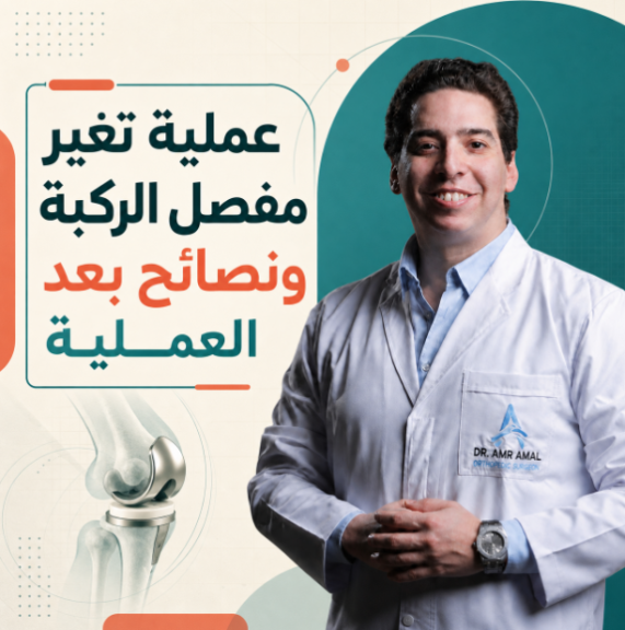 عملية تغير مفصل الركبة ونصائح بعد العملية