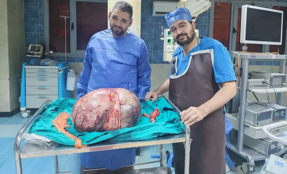 رئيس جامعة المنيا يُهنئ الفريق الطبي بنجاح استئصال ورم مبيضي عملاق يزن 24 كيلوجرامًا