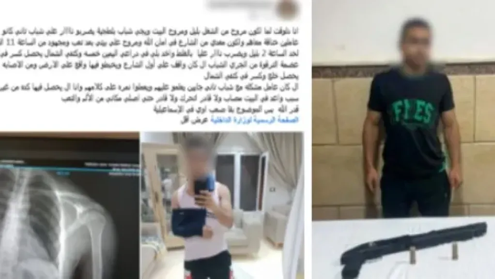الأمن يكشف ملابسات إصابة مواطن بطلق ناري خلال مشاجرة بالإسماعيلية